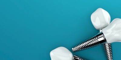 Icon style image for blog: 5 Reasons you should choose dental implants with Cheltenham Dental Spa