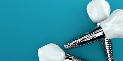 Icon style image for blog: Confused about dental implants?